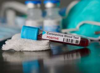 Otoritas Hongkong Rilis Dugaan Penularan COVID 19 Dari Manusia Ke Hewan (nytimes.com)